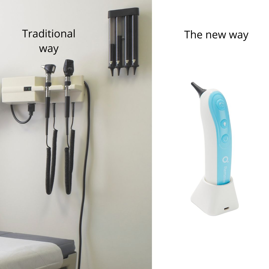 Remmie PRO Digital Otoscope