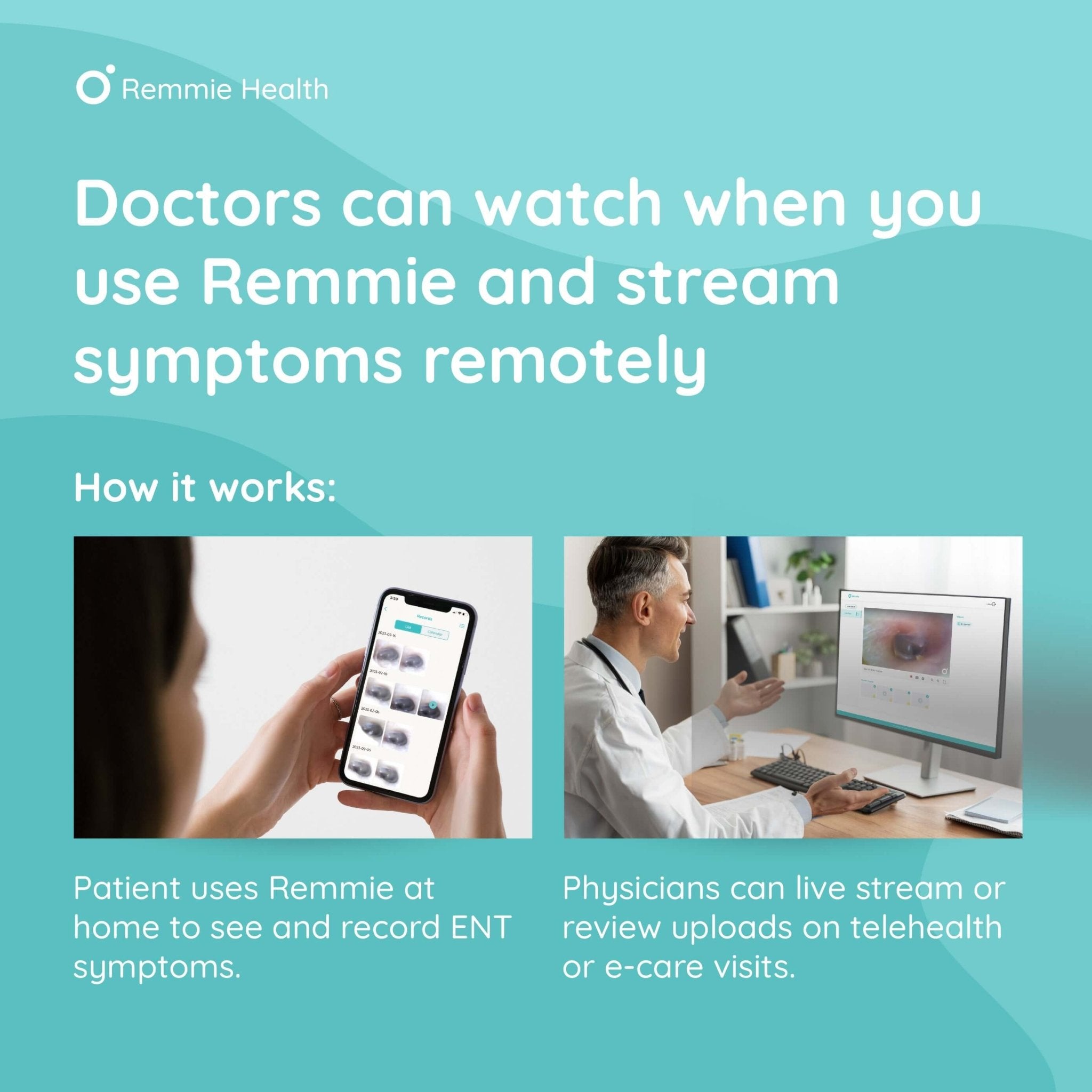 Remmie 3 Next Generation Intelligent Home Otoscope - Remmie Health