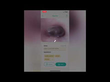 Load and play video in Gallery viewer, Remmie Dolphin Otoscope
